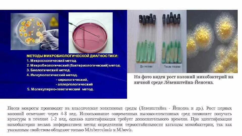 Посев легких