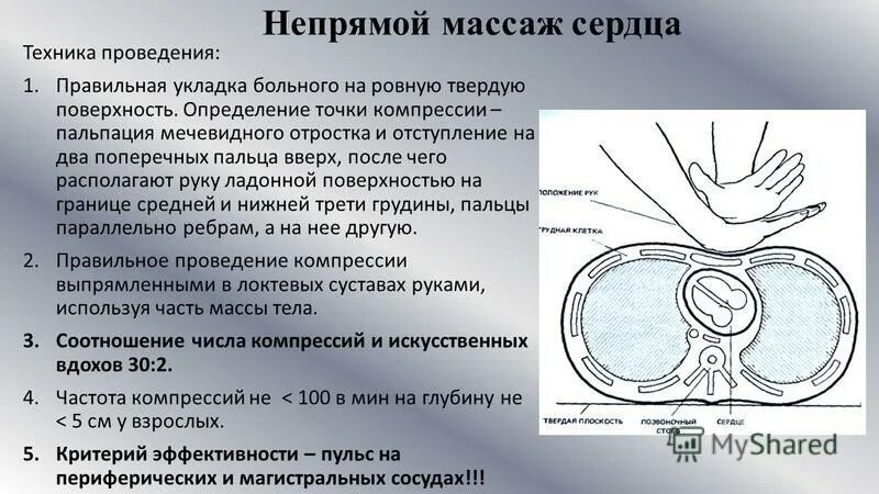 методика проведения массажа сердца. методика проведения массажа сердца. как проводится наружный массаж сердца кратко. методика проведения массажа сердца. основными правилами проведения непрямого массажа сердца являются:.