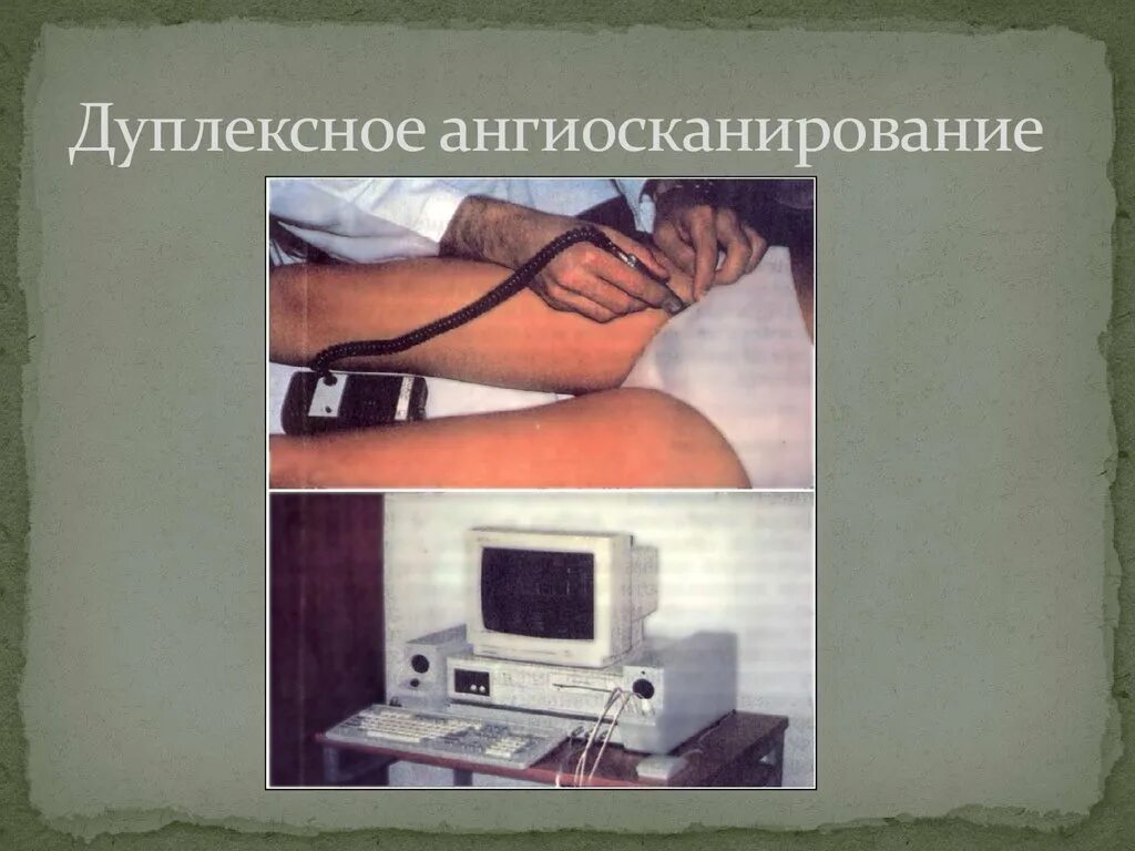 Ангиосканирование нижних конечностей. Дуплексное ангиосканирование. ультразвуковое ангиосканирование дуплексное сканирование. ультразвуковое дуплексное ангиосканирование сосудов конечностей. дуплексное ангиосканирование вен нижних конечностей.