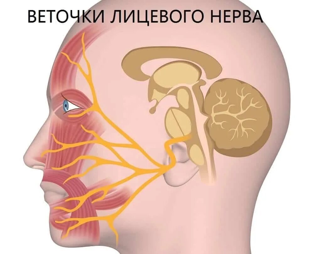Воспаление тройничного лицевого нерва симптомы. Тройничный нерв на лице. неврит тройничного нерва. тригеминальная невралгия. -неврит (воспаление нерва)..