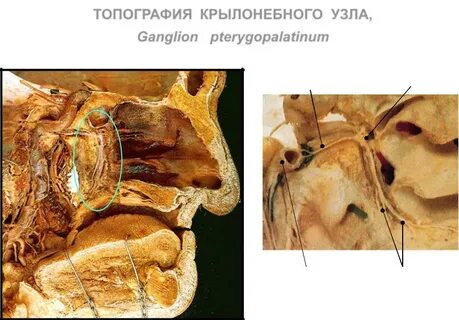 Черепной ганглий