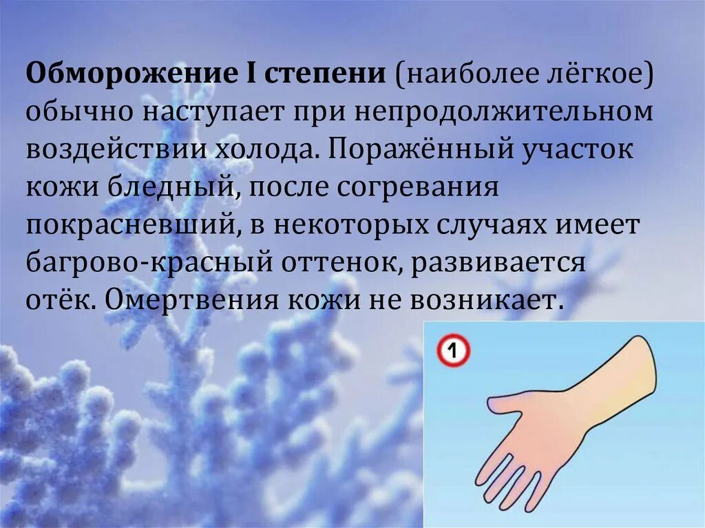 Обморожение признаки и первая помощь. Обморожение признаки и первая помощь