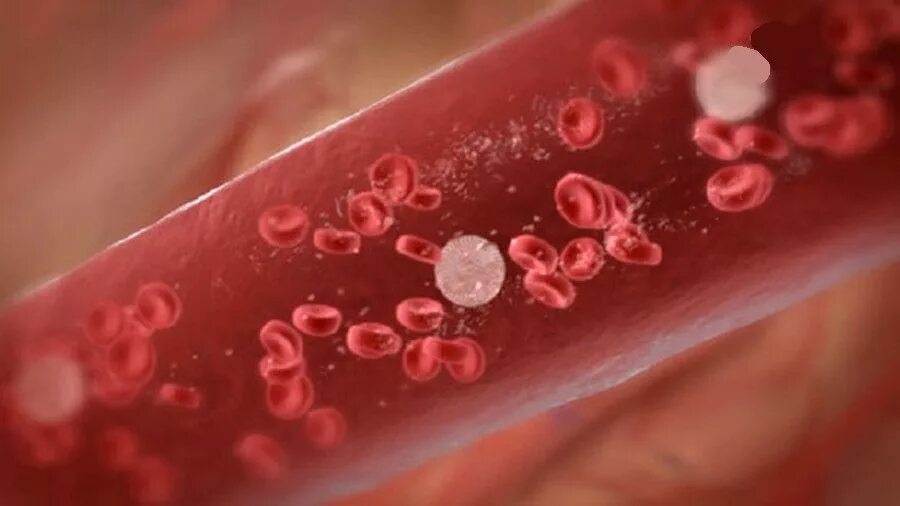 Злокачественные заболевания крови. Клетки крови.