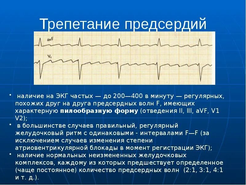 Нарушение предсердного ритма