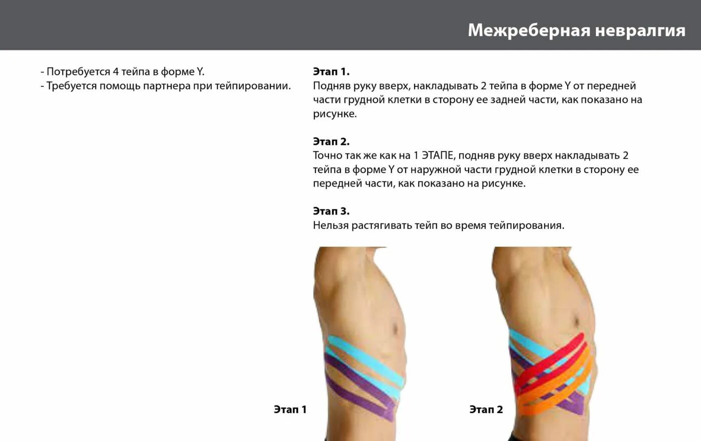 Помощь при межреберной невралгии. Тейпирование ребер при невралгии. межреберная невралгия тейпирование. тейаипрыание ребер при невралгии. тейпы при межреберной невралгии.