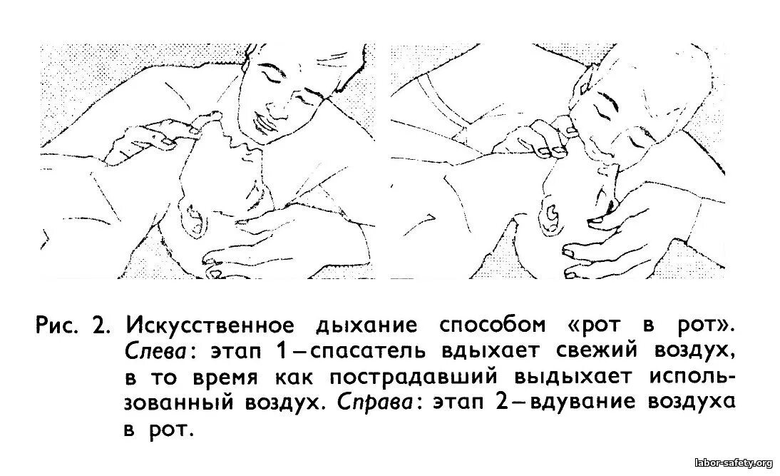 Искусственное дыхание через рот. Вдувание воздуха у детей. Методы вдувания воздуха пострадавшему. Искусственное дыхание метод вдувания.