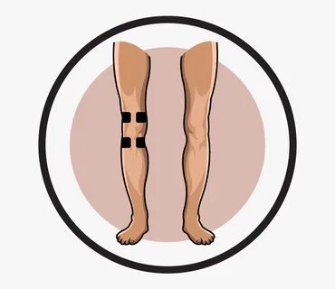 Knee Clipart Injured Knee, HD Png Download , Transparent Png