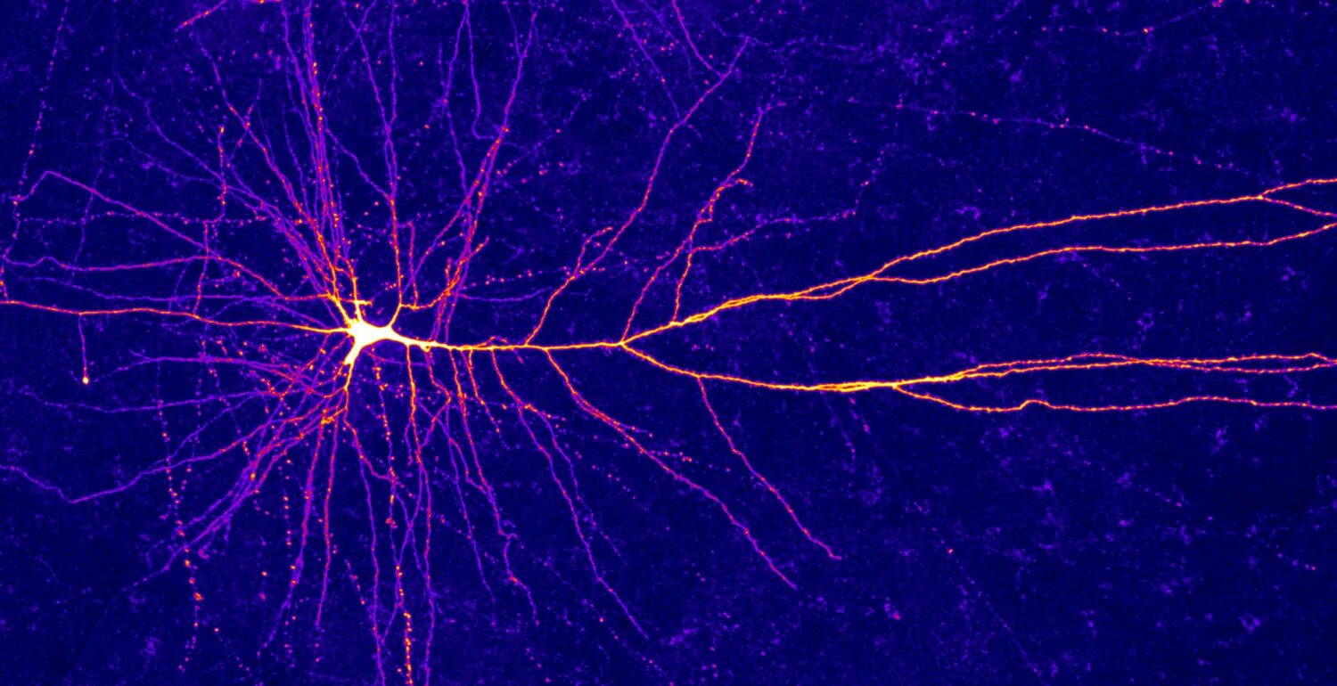 Клетки мозга человека состоят из. Дендрит нейрона. Нейроны мозга. Клетки головного мозга. Нейронные дорожки.