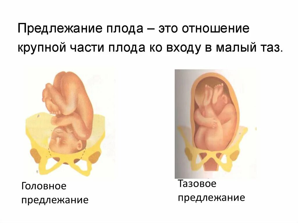 Предлежание положение позиция вид. Головное и тазовое предлежание. прилежащая часть плода это. головное предлежание плода.