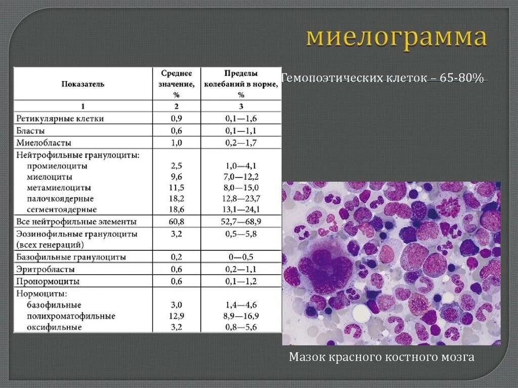 Сколько хромосом содержит эритроцит собаки. Миелограмма хронический миелобластный лейкоз. Хронический моноцитарный лейкоз показатели крови. Миелограмма норма плазматических клеток. Острый миелобластный лейкоз миелограмма.