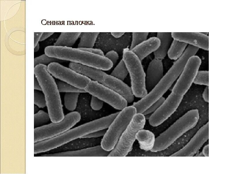 Строение бактерии сенной палочки. Сенные культуры. Bacillus subtilis препараты для человека. Сенная палочка b. Свежескошенное сено.