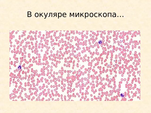 Презентация "Кровь. Переливание крови" (11 класс) по биологии - скачать проект