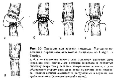 Хирургия пищевода