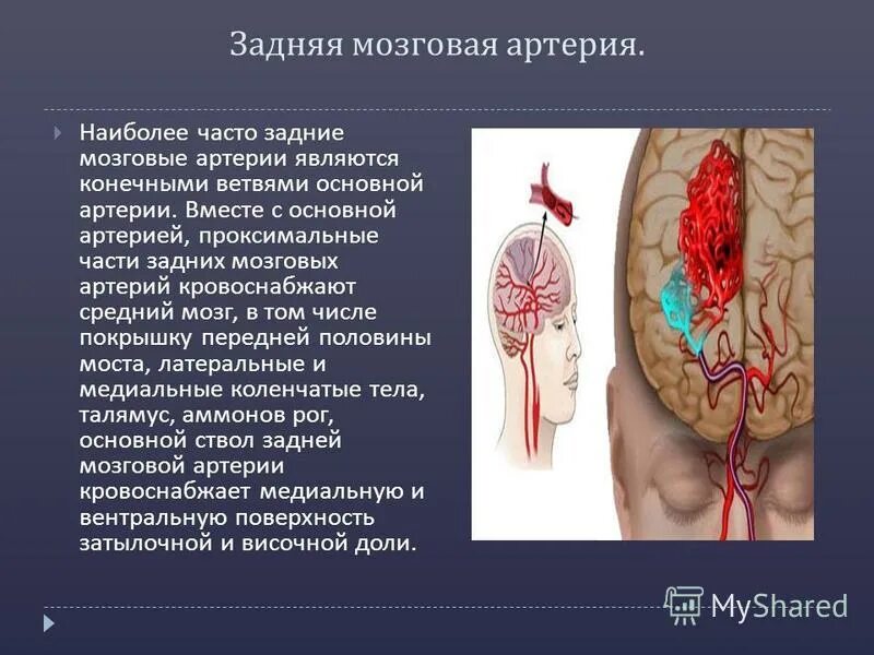 Задняя мозговая артерия кровоснабжает доли. Кровоснабжение головного мозга схема бассейнов. Артерии питающие головной мозг схема. Задняя мозговая артерия кровоснабжает. Внутренняя сонная артерия кровоснабжение головного мозга.