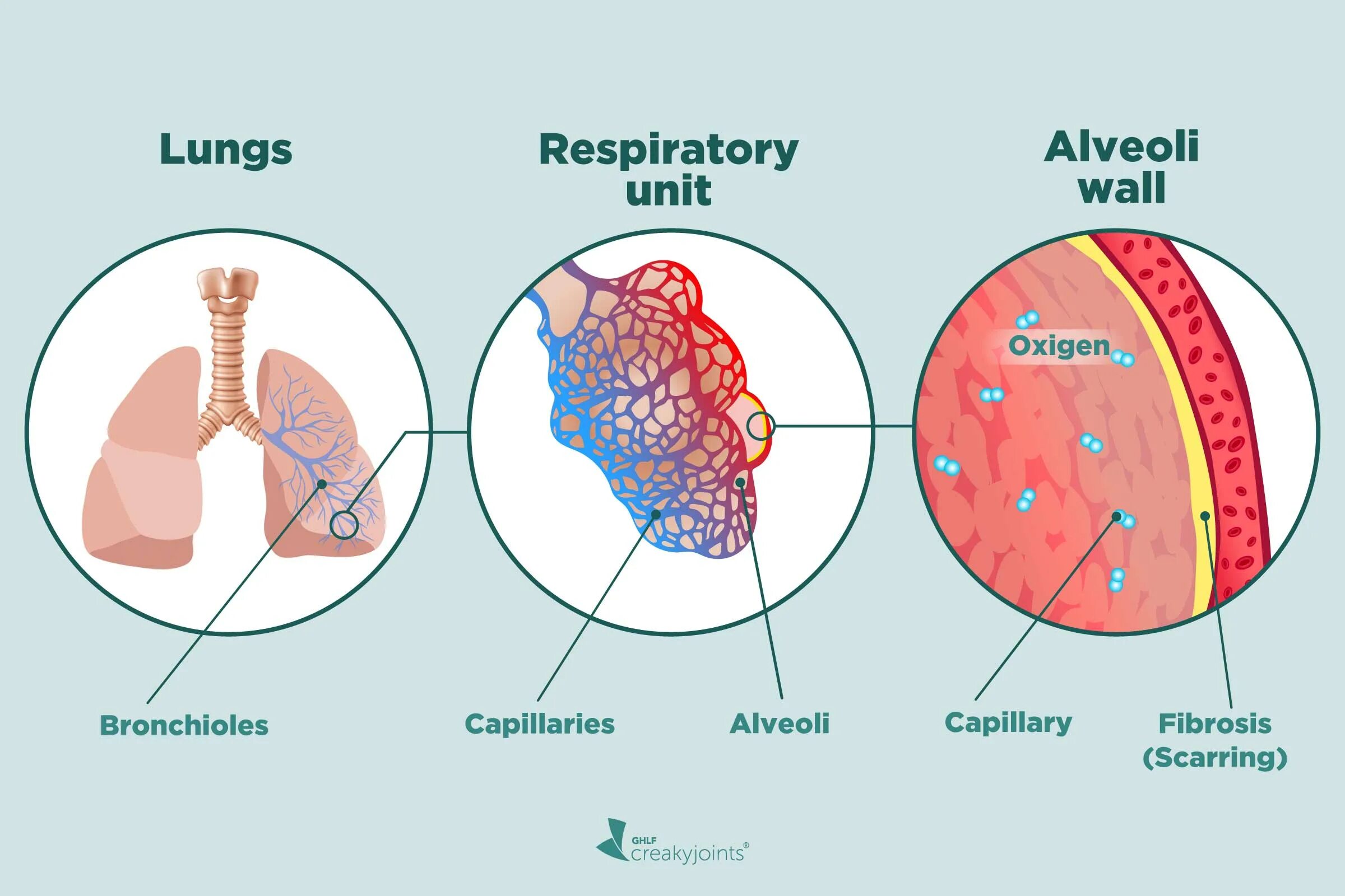 Diseases associated