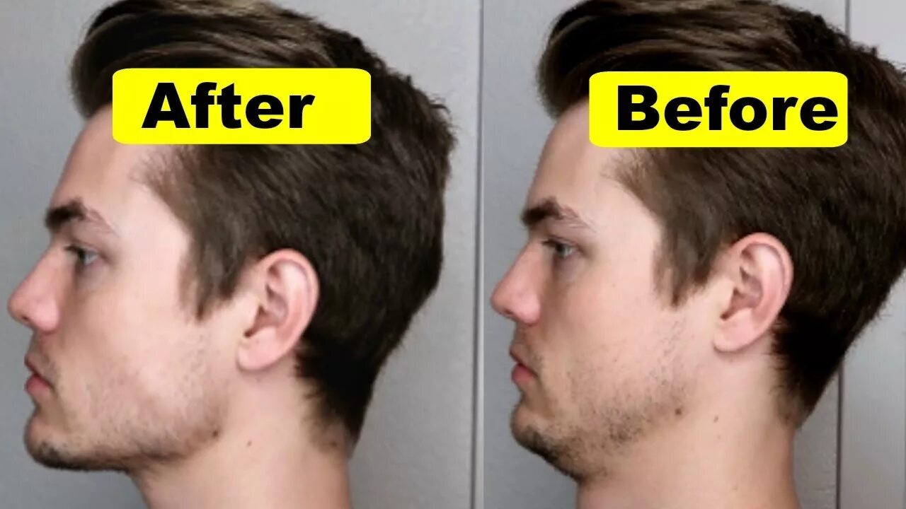 Jaw me. Strong chin. массивная челюсть. jawline упражнения. weak jawline.