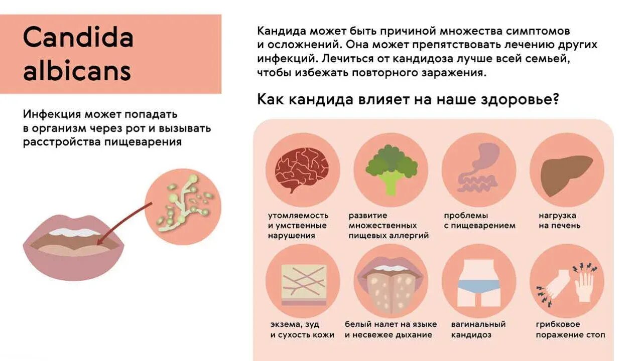 Сколько проходит молочница у женщин. Молочница у женщин симптомы.
