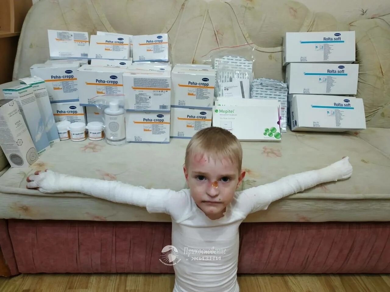 Болезнь бабочки фото: "Хрустальные" девочки, мальчик-"бабочка" и Никита, который