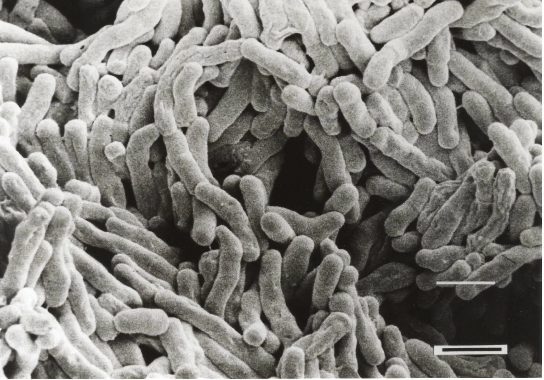 Микобактерия Бовис. Палочка Коха Mycobacterium tuberculosis. Бацилла Коха под микроскопом.