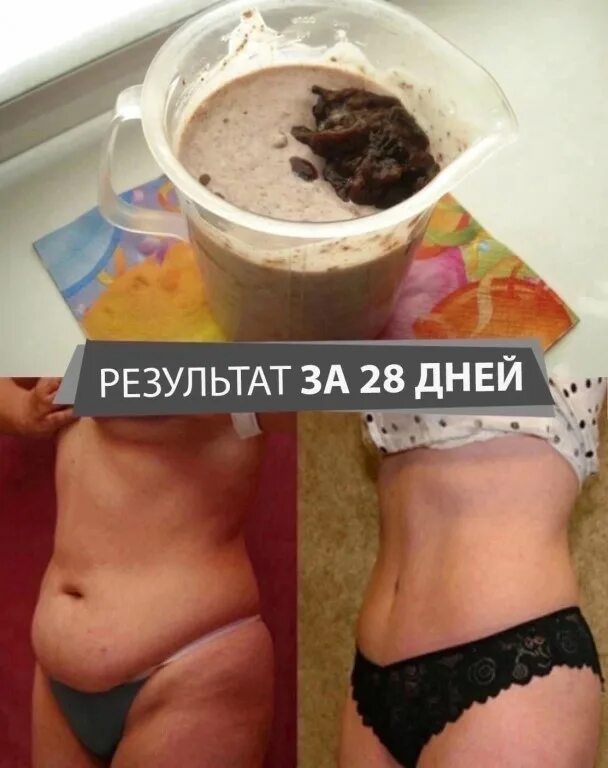 Гормональный живот это. Гормональный животик. стрессовый живот и гормональный живот. кортизоловый живот. гормональный живот у девушек.