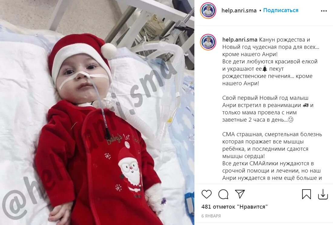 Сма варя. Анри сурманидзе сма. ребенок со сма габриелян. сколько живут дети с сма.