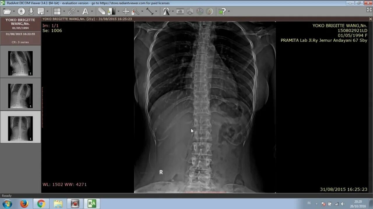 Dicom viewer. Radiant dicom. радиант просмотрщик. radiant dicom viewer (64-bit). радиант кт.