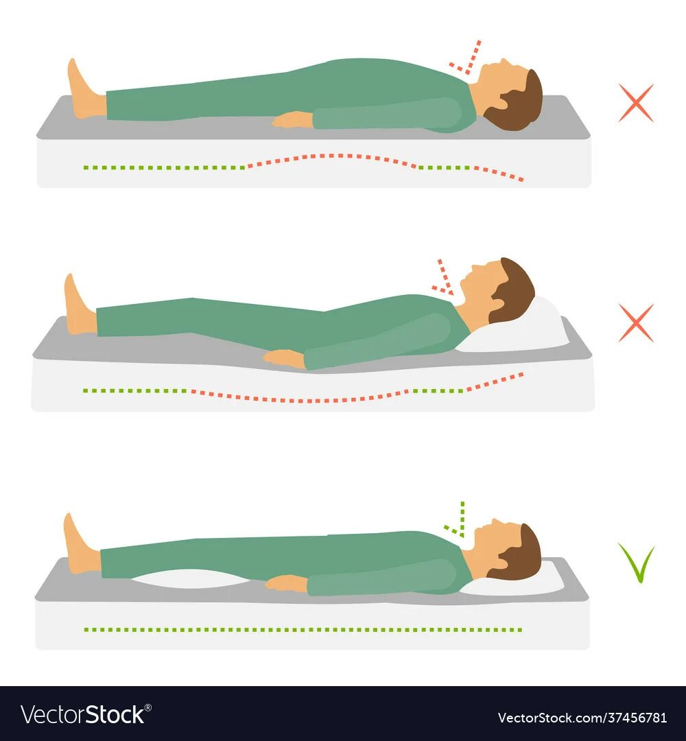 Болит спина от матраса. Правильное положение позвоночника во сне. Правильные позы для позвоночника. Правильный сон для позвоночника. Правильная поза для сна на спине.