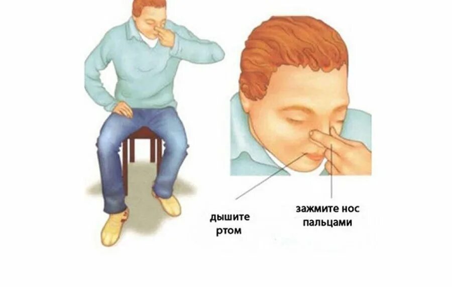 Кровотечение ротовой. Кровотечение ротовой