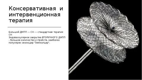 Закрытие дмпп окклюдером