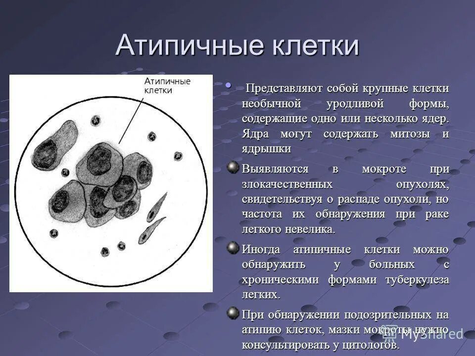 Мокрота на атипичные клетки алгоритм. Мокрота атипичные клетки исследование мокроты. атипичные клетки при микроскопии мокроты. клетки с признаками атипии в мокроте. цитологическое исследование на атипические клетки.