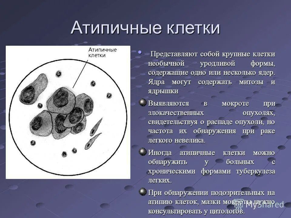 Плоский эпителий в цитограмме. Мокрота атипичные клетки исследование мокроты. Исследование на атипичные клетки. Цитологическое исследование на атипические клетки. Мазок мокроты на атипичные клетки.