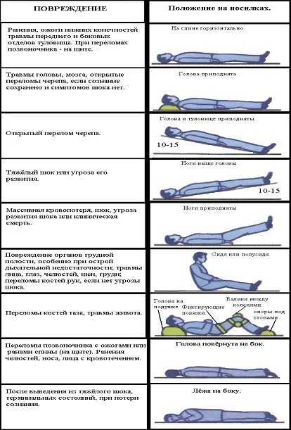 Транспортировка пострадавших при ранениях конечностей. Алгоритм проведения иммобилизации таблица. Способы транспортировки при переломах. Положение пострадавшего при переломе нижних конечностей.