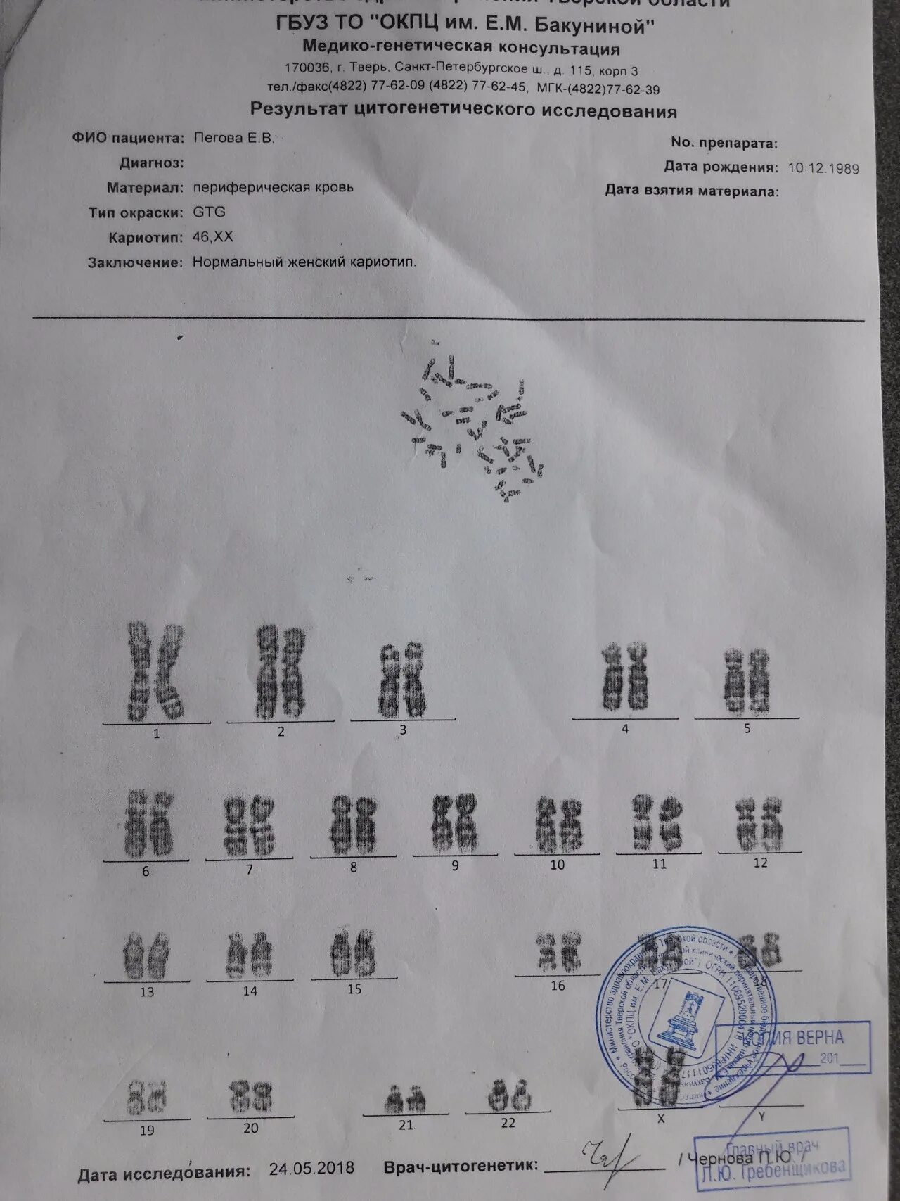 Кариотипирование супругов цена. Кариотипирование супругов расшифровка результатов. Кариотип анализ. Кариотип Результаты анализа. Анализ на кариотип (кариотипирование)..