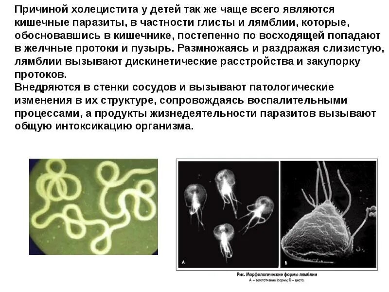 Лямблии у человека. Кишечные лямблии у ребенка.