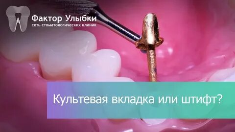 Вкладка со штифтом