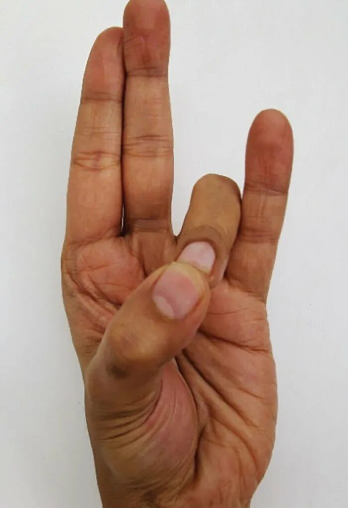 Большой палец изгиб
