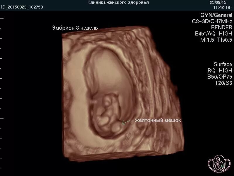 См в 7 недель. Эмбрион на 7 неделе беременности УЗИ 3д. Беременность 8 недель фото эмбриона размер. 7 Недель беременности 3д УЗИ.