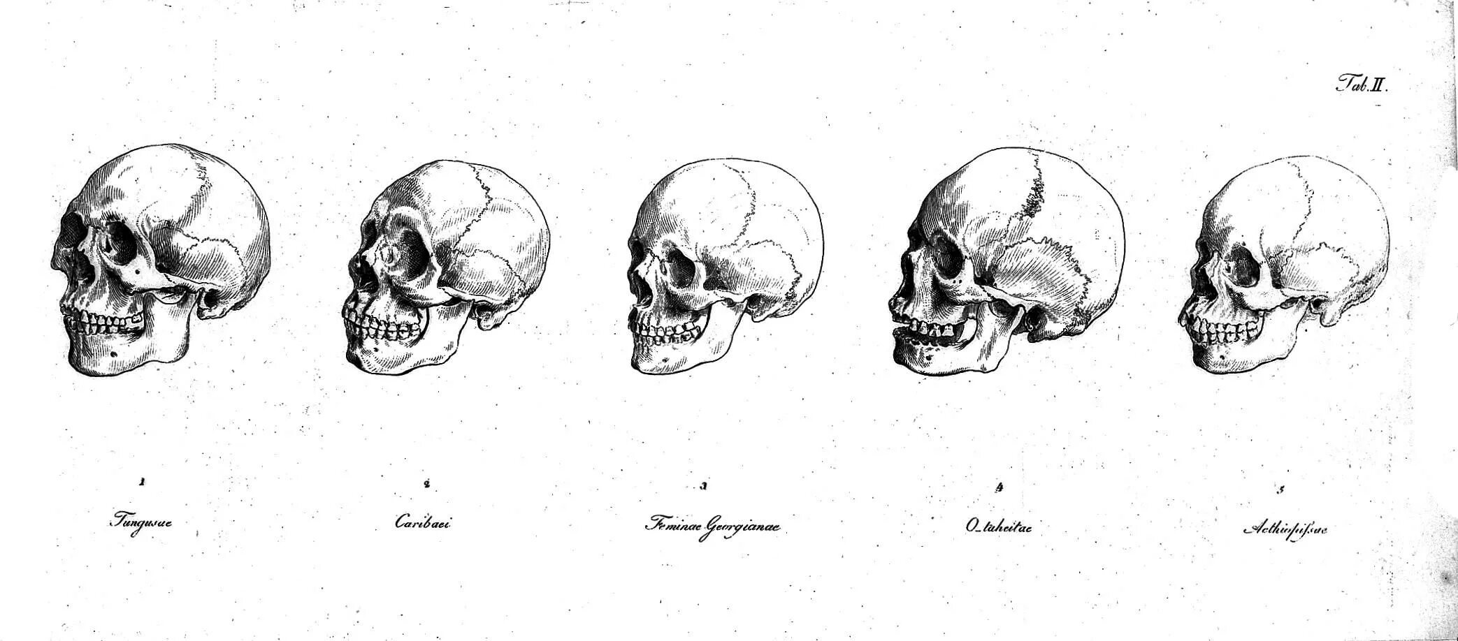 Варианты формы черепа. Антропология черепа рас. Форма черепа человека сбоку. Антропология череп монголоида.