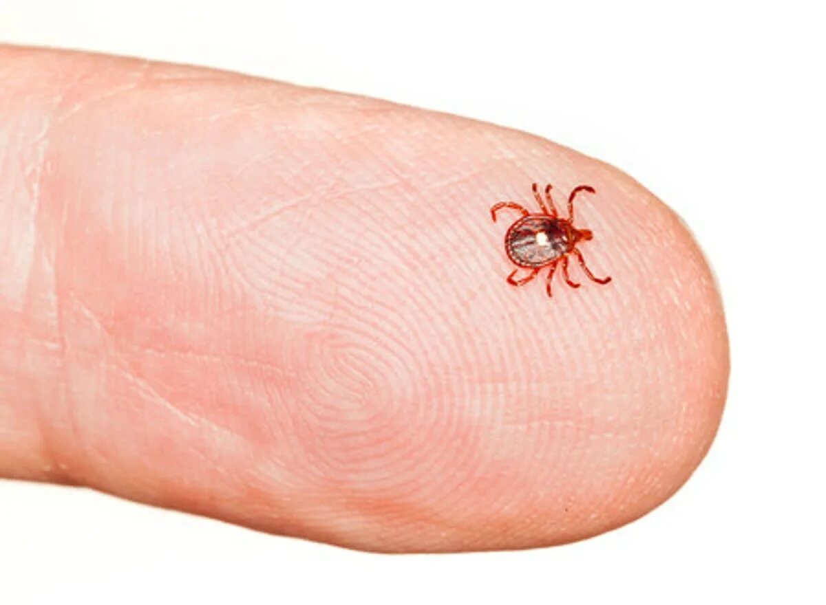 Tick bite make you allergic to