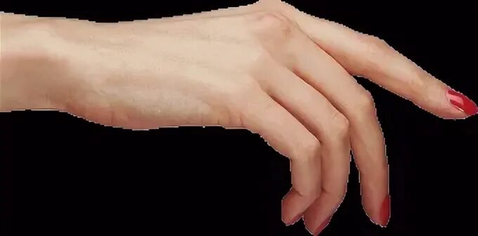 Нервный тик пальца руки. Сустав большого пальца руки. Туннельный синдром запястья кисти. Лигаментит пальца кисти. Туннельный синдром запястья кисти.