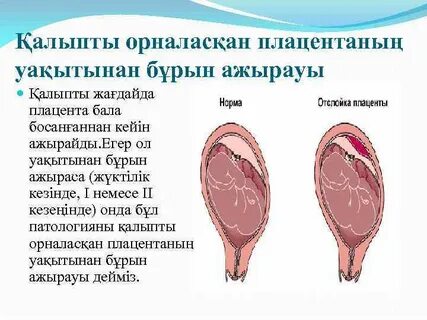 Догги стиліндегі бөрене киген әйелдер