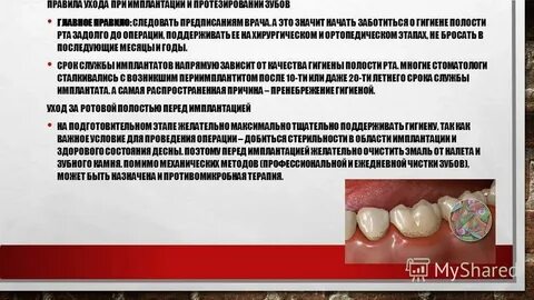Антибиотики после имплантации