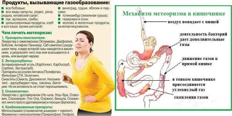 Как избавиться от газов и вздутия женщине
