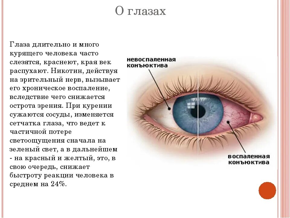 На глазах утром появляется. Покраснение глаз и слезотечение. Покраснение глаз причины.