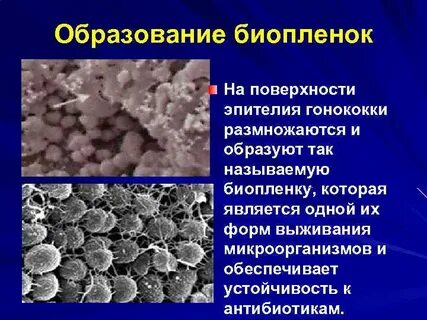 Бактерии выживают