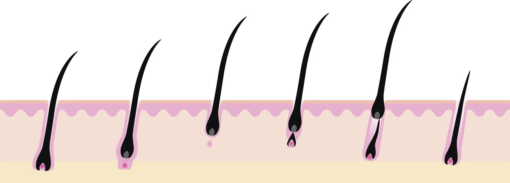 Корни волос Графика. Волосы на теле иллюстрация. Жизненный цикл волос в подмышках. Луковицы волос Графика.