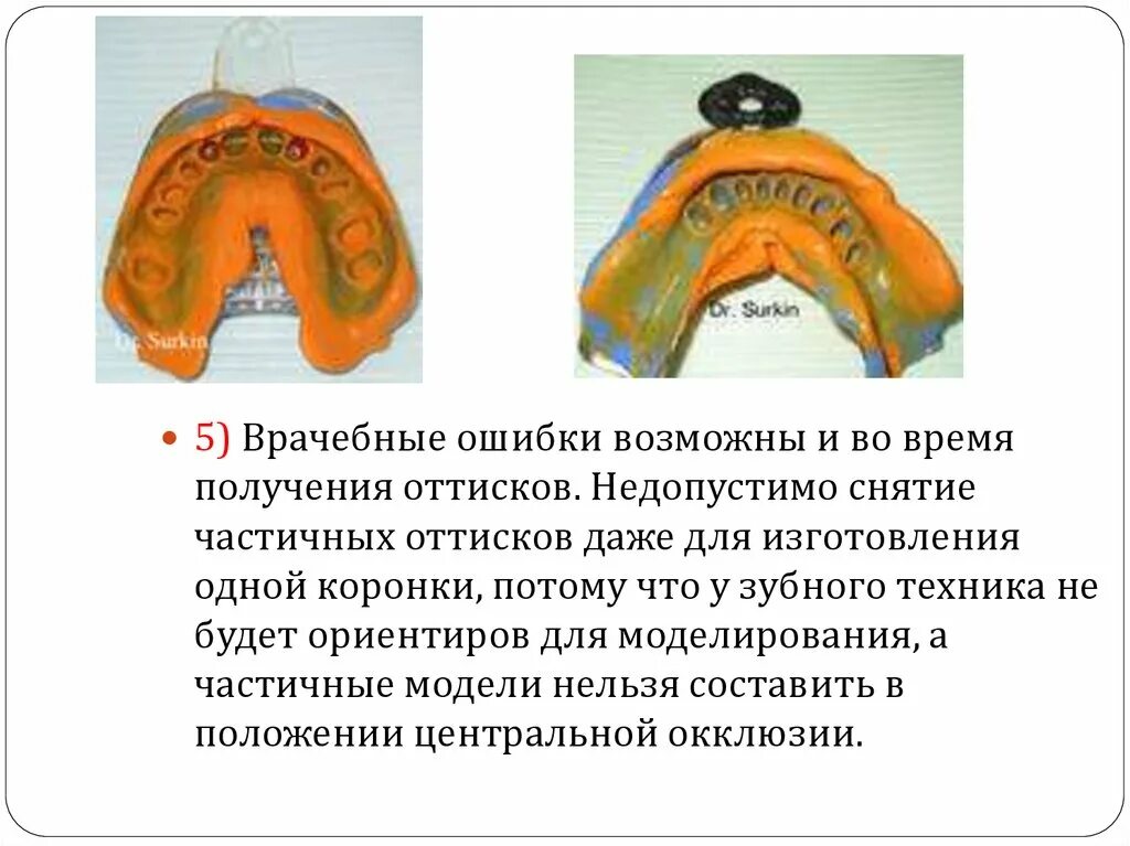 Ошибка протезирование