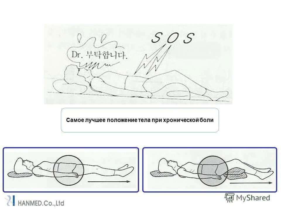 правильное положение шеи и головы. удобное положение для сна. правильная поза для сна. правильное положение при сне. правильное положение сна на спине.