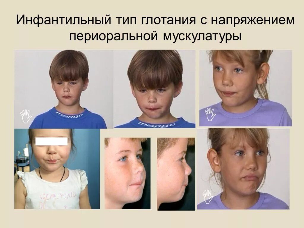 Типа у ребенка форум