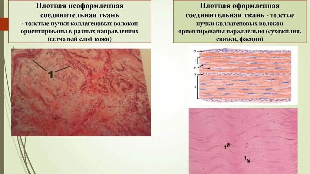 Плотная оформленная. Плотная неоформленная соединительная ткань гистология. плотная волокнистая неоформленная соединительная ткань. плотная волокнистая оформленная соединительная ткань функции. плотная волокнистая неоформленная соединительная ткань функции.